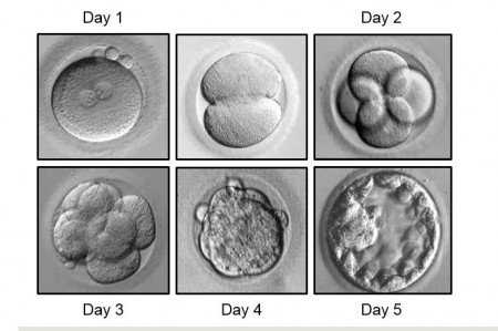 Six images of an embryo developing under a microscope on days 1 through 5 after fertilization.